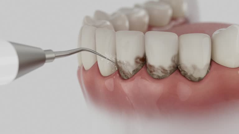 Reliable Dental Implants contractor in Pardeeville, WI by Smile Center Dentistry